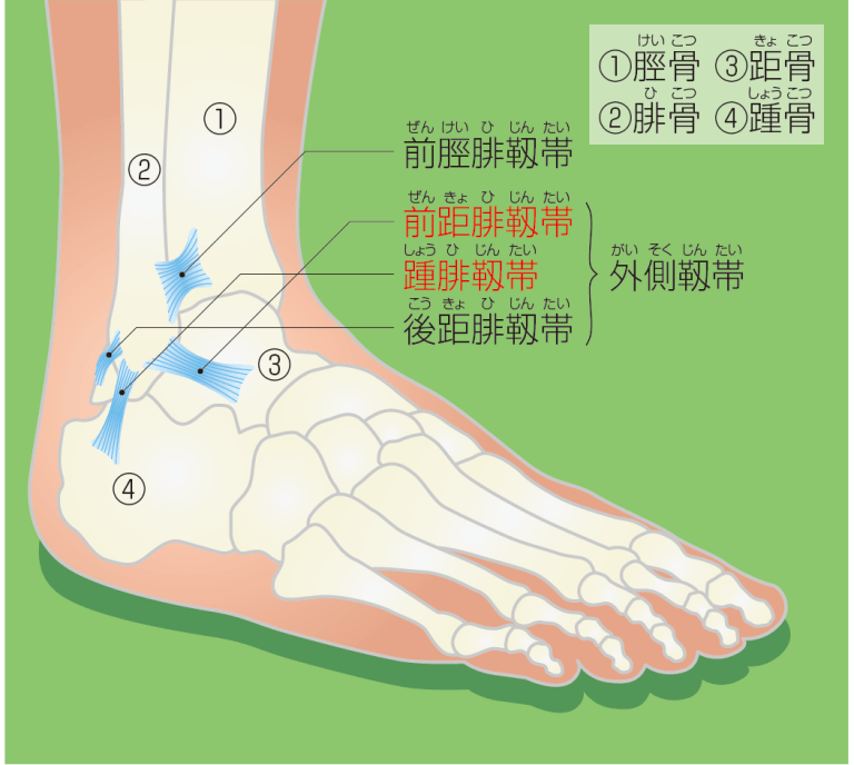 足関節捻挫